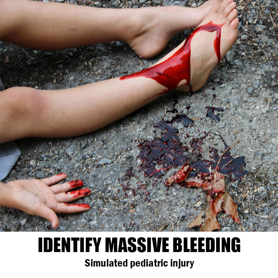 Identify Massive Bleeding